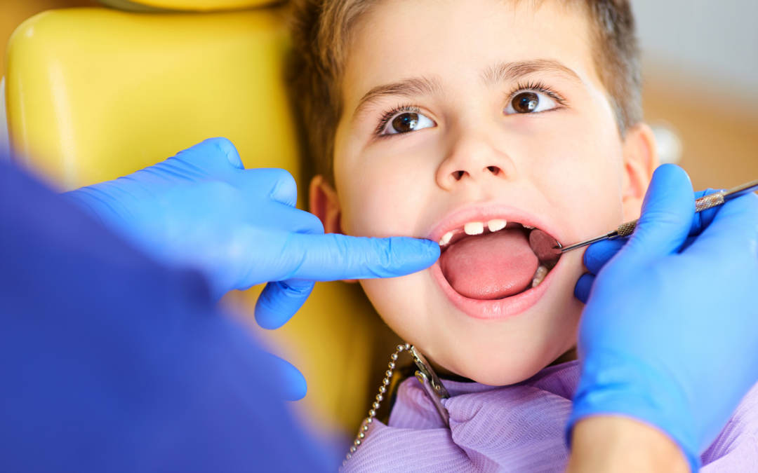 Carie denti da latte: come comportarsi se capita ai tuoi figli