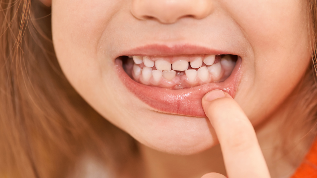 Dentizione bambini: consigli per i genitori - Progetto Sorriso