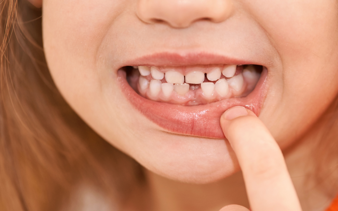 Dentizione bambini: consigli per i genitori