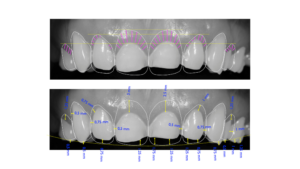 DSD digital smile design