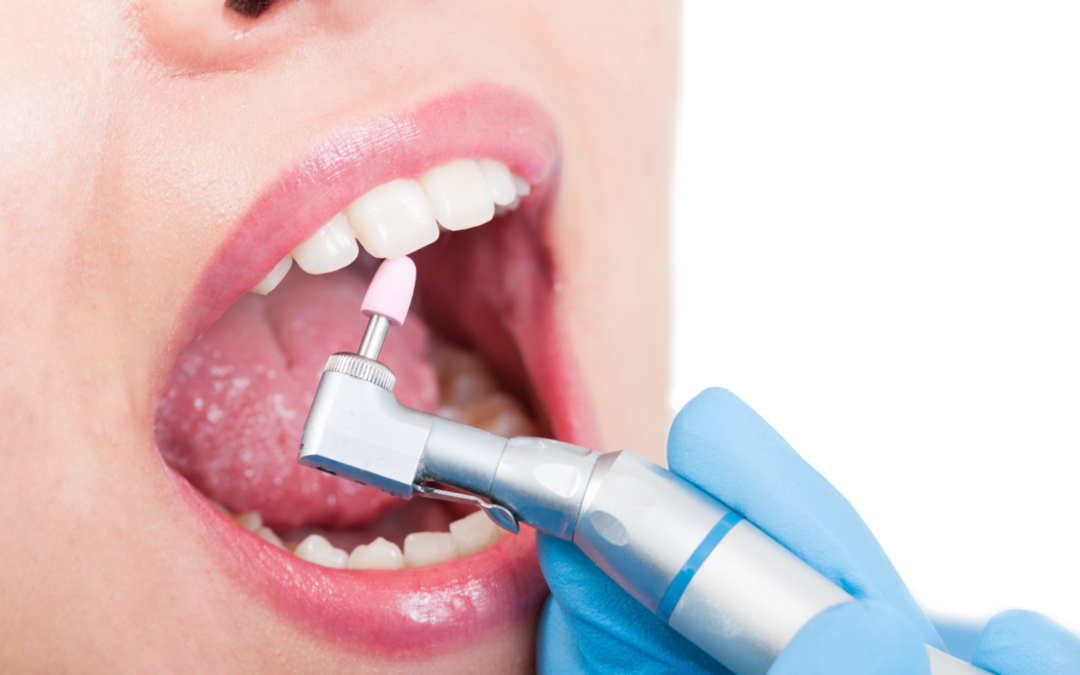 Polish denti per dire addio alle macchie