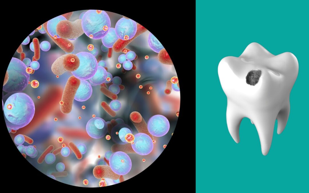 Biofilm batterico: cos’è e perché va rimosso