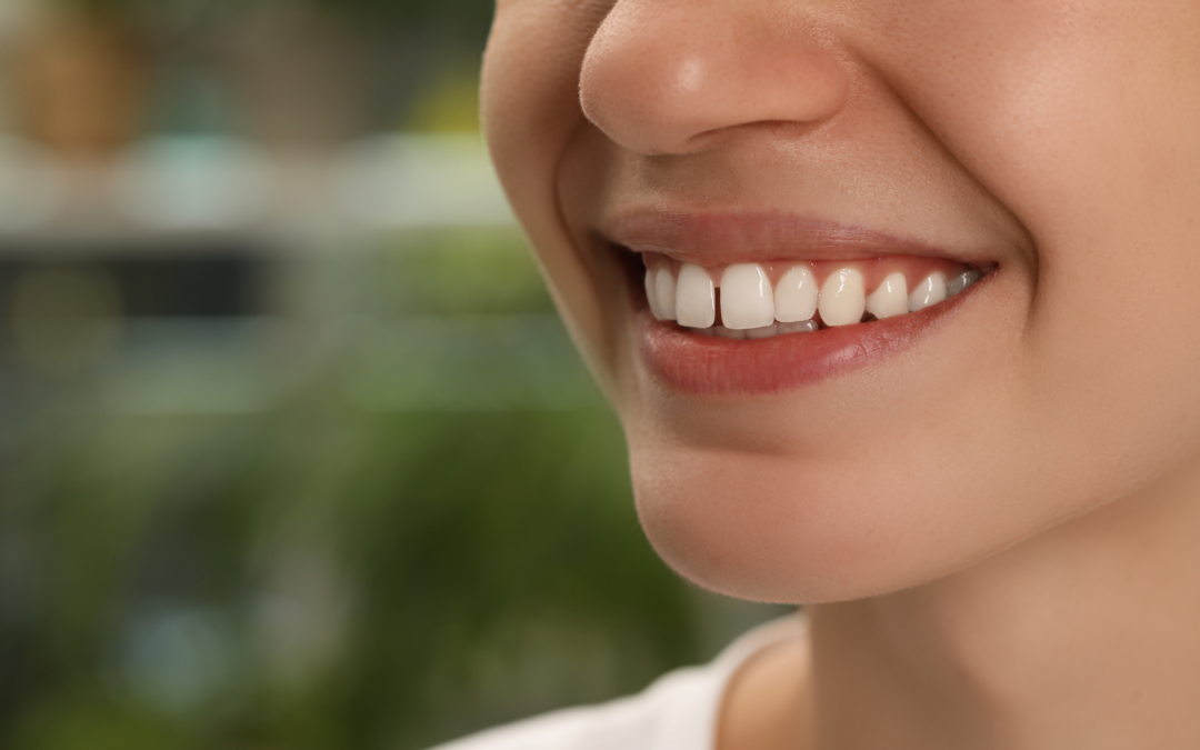 Spazio fra i denti: come ridurlo e ritrovare il sorriso
