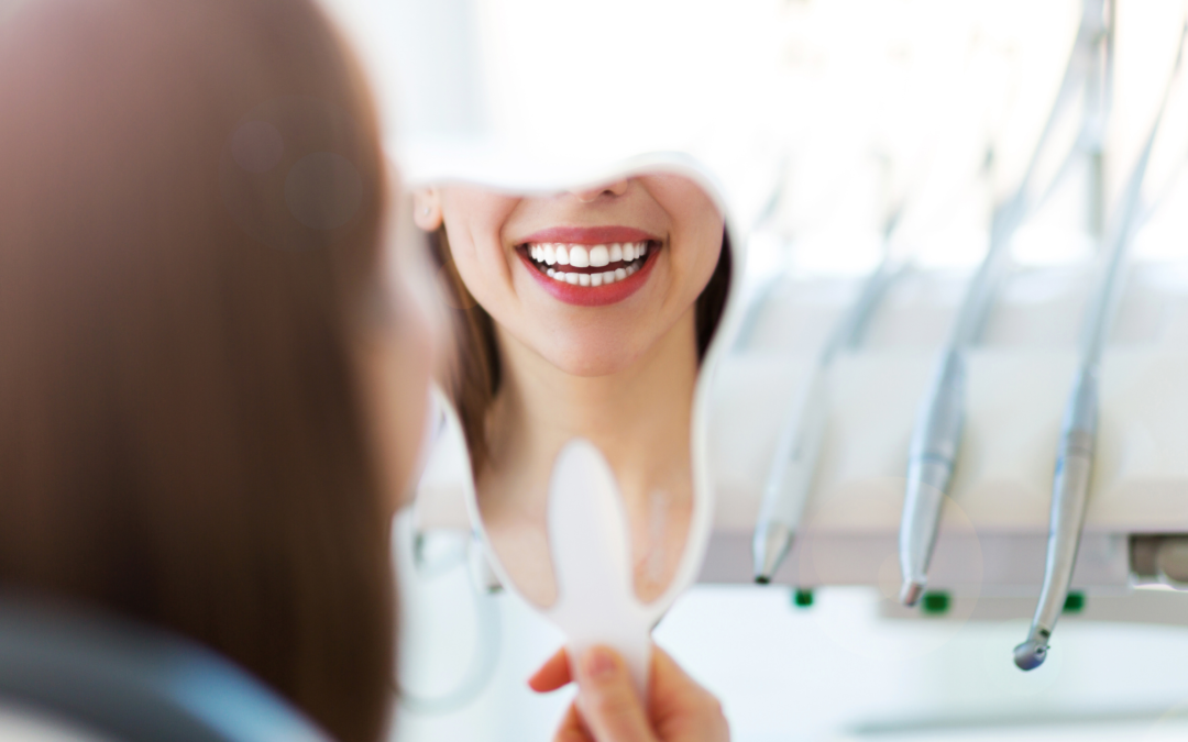 White spot denti: che cosa sono e come trattare le macchie dentali