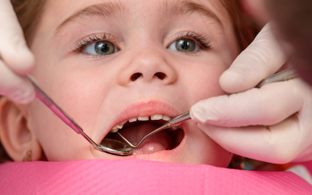 Perdita dei denti da latte: perché avviene, a che età e cosa fare?