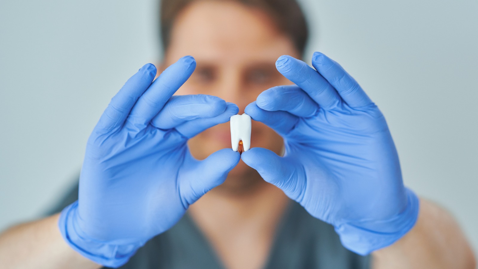Dente necrotico: diagnosi e trattamenti