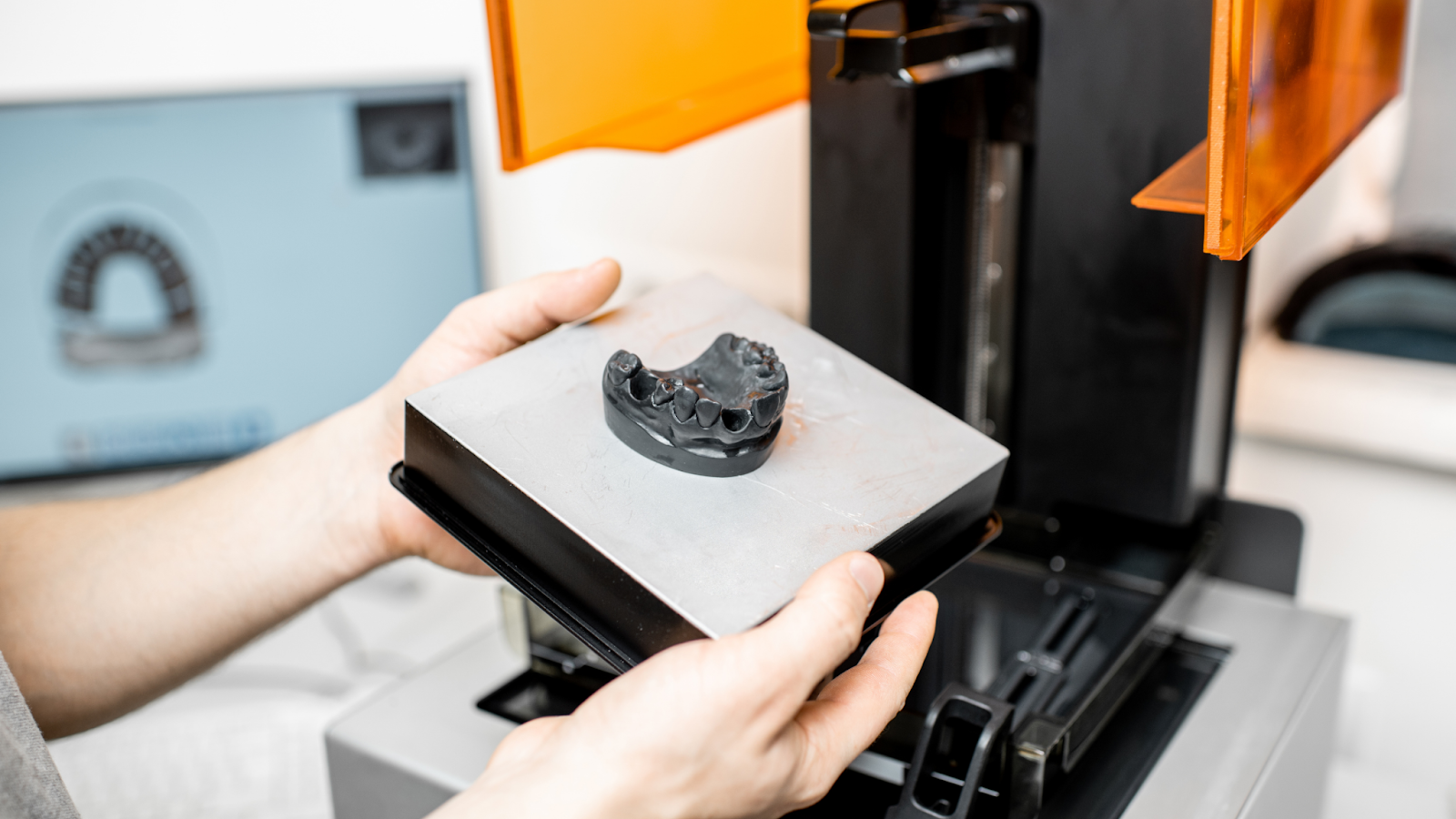 Stampante 3D dentale: la tecnologia che aiuta il sorriso