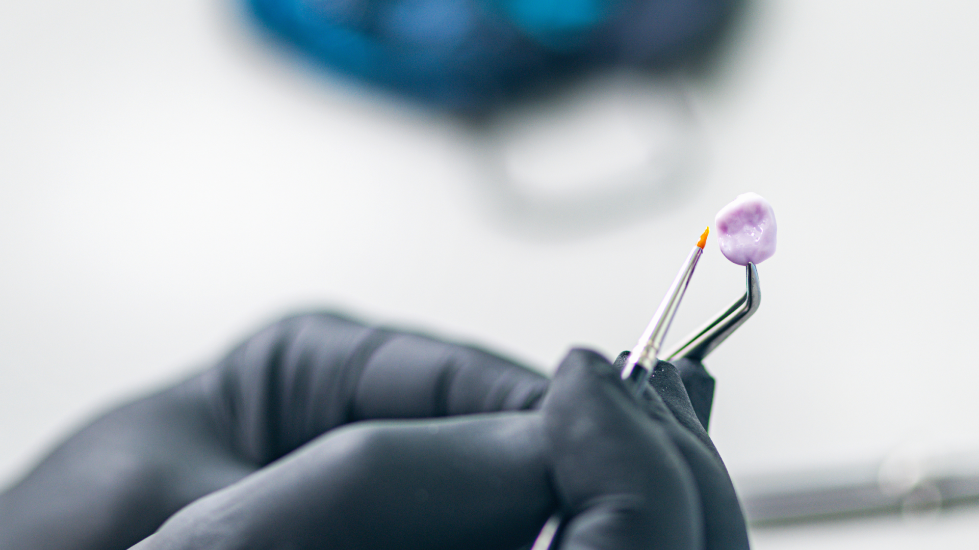 Capsula dentale scheggiata: come proteggere il tuo sorriso