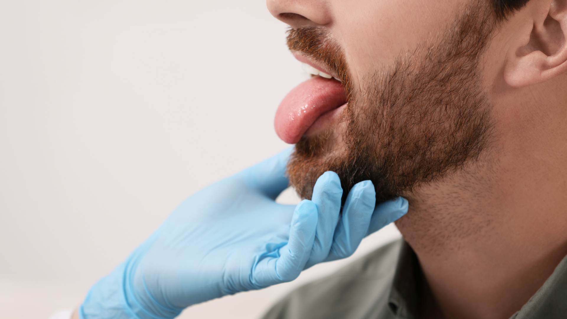 Candidosi cavo orale: come riconoscerla e intervenire in tempo