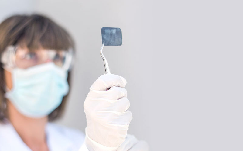 Dentista endodontista: l’esperto della polpa dentale