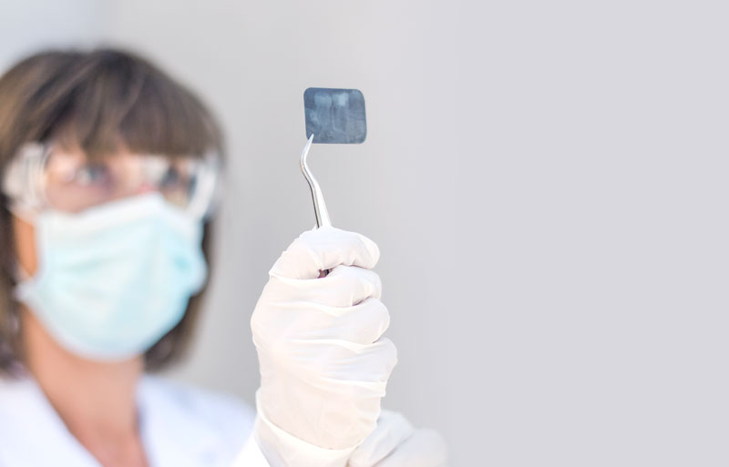 Dentista endodontista: l’esperto della polpa dentale
