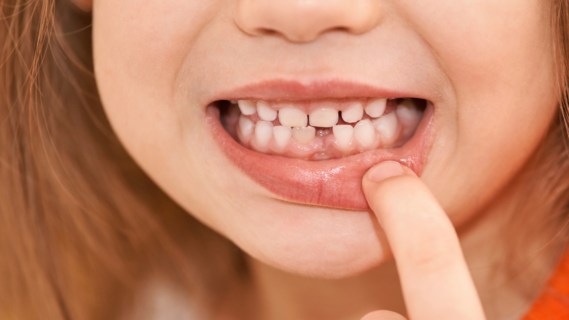 Dentizione bambini: consigli per i genitori