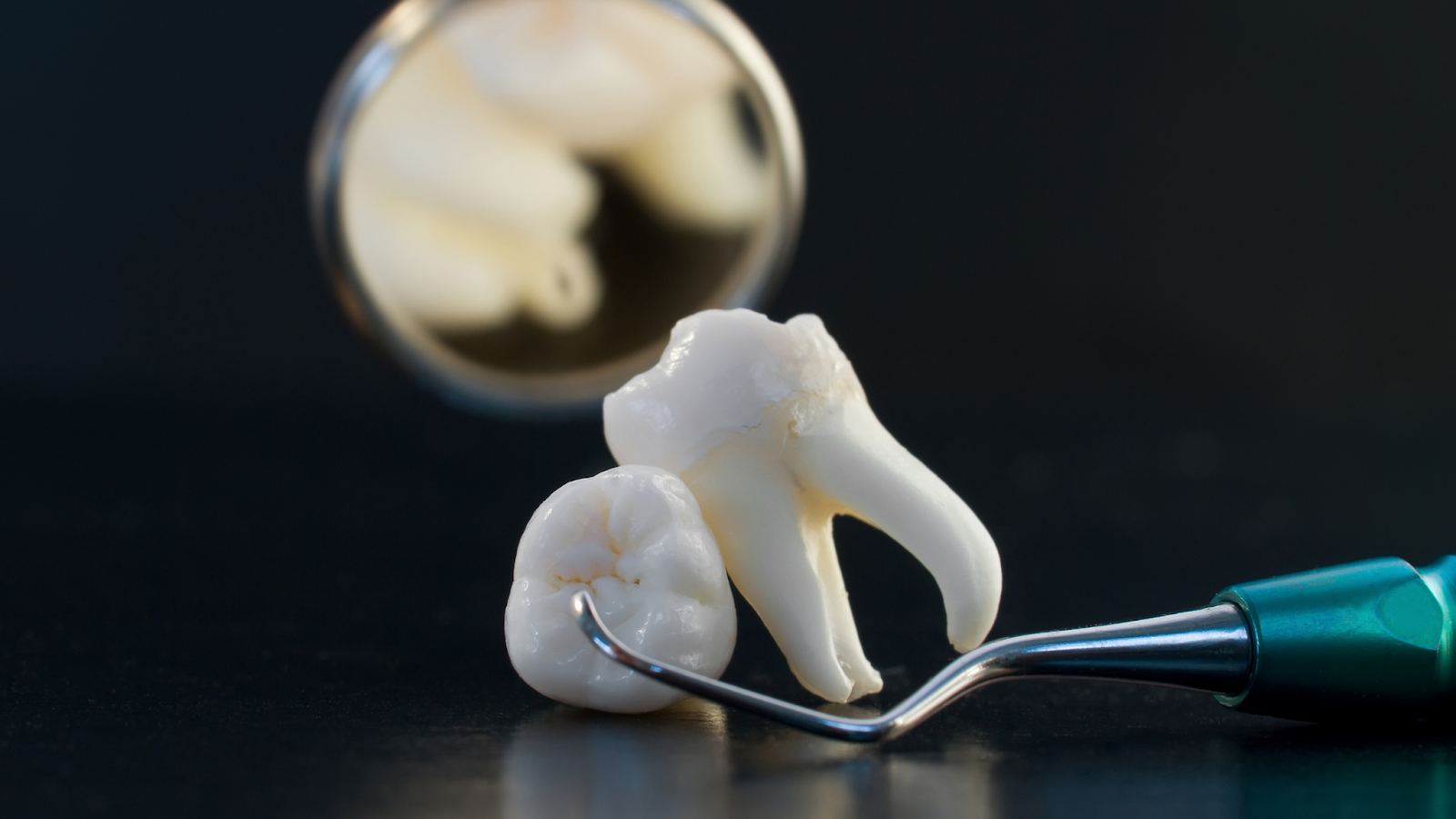 Cos’è l’endodonzia dentale e come funziona