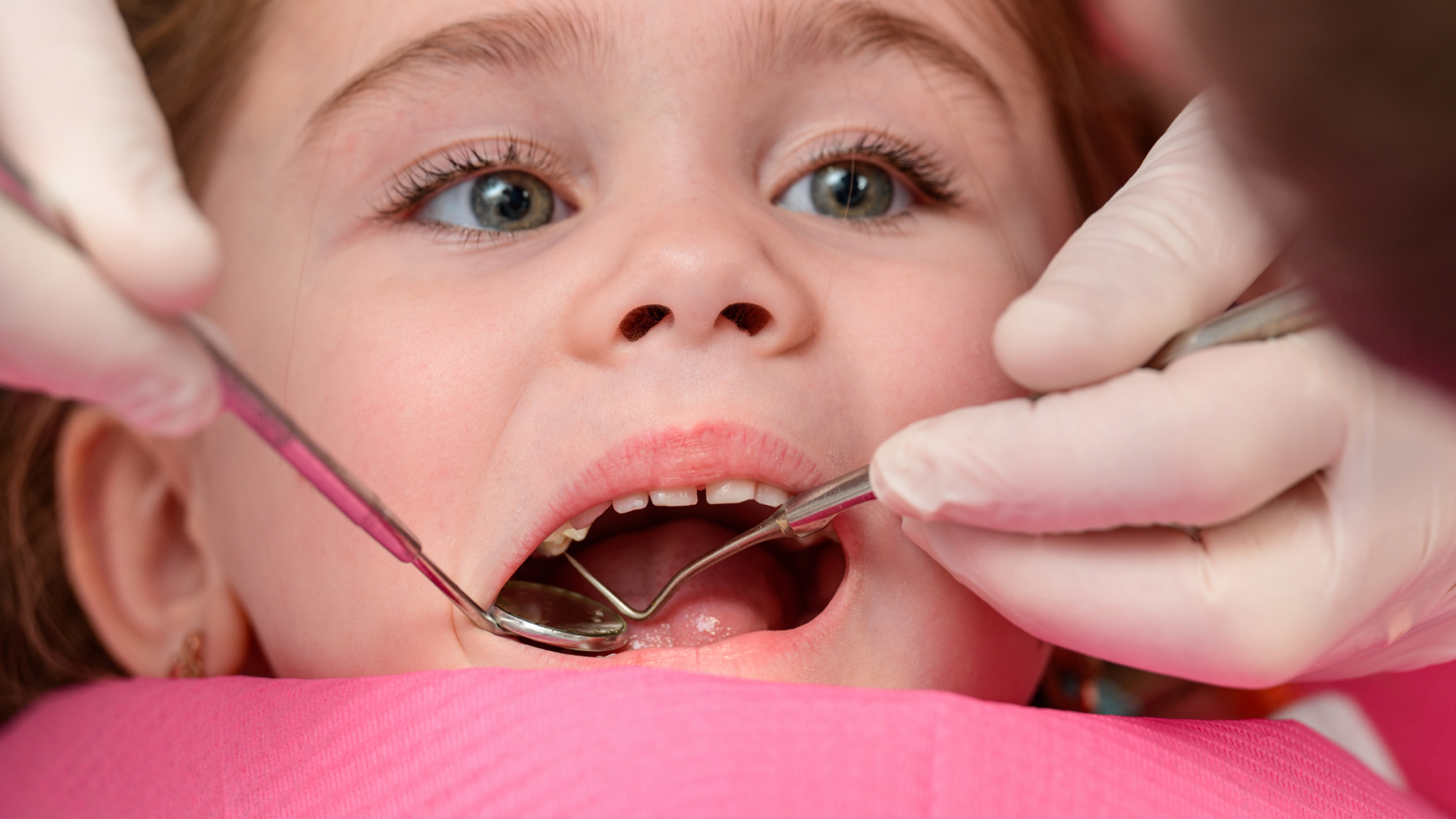 Perdita dei denti da latte: perché avviene, a che età e cosa fare?