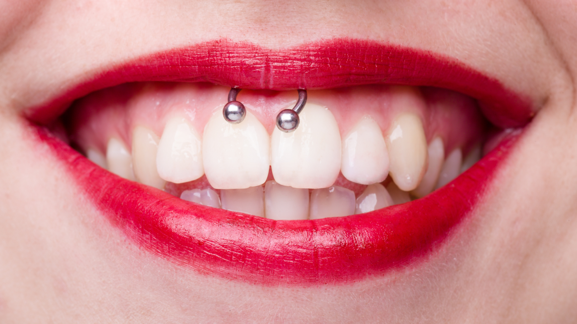 Piercing alla bocca: rischi per denti e gengive da non sottovalutare