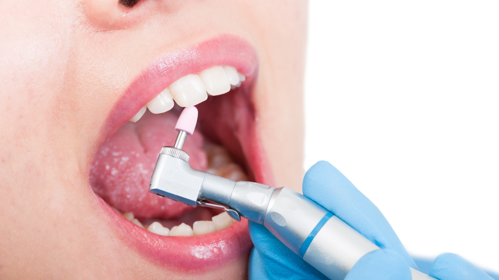 Polish denti per dire addio alle macchie